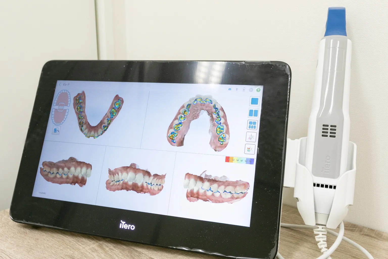 マウスピース型矯正歯科装置 ｢アイテロ｣によるマウスピース型矯正歯科装置(インビザライン)