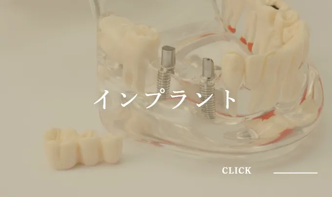 インプラント
