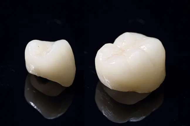 セラミックについて